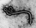 ebola virus/photo bio.davidson.edu
